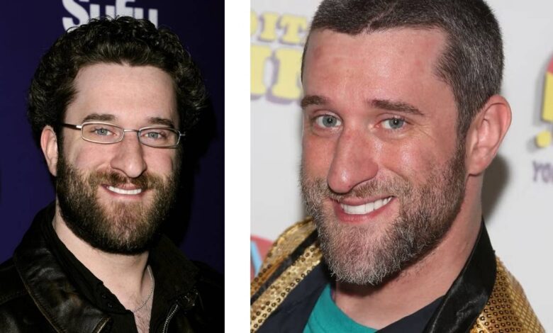 Dustin Diamond